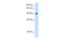 Nuclear Receptor Subfamily 3 Group C Member 2 antibody, NBP1-70640, Novus Biologicals, Western Blot image 