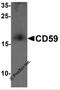 CD59 Molecule (CD59 Blood Group) antibody, 7235, ProSci, Western Blot image 