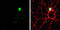 SATB Homeobox 2 antibody, GTX134105, GeneTex, Immunocytochemistry image 