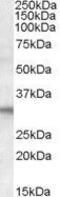 Four And A Half LIM Domains 2 antibody, GTX15715, GeneTex, Western Blot image 