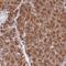WW Domain Binding Protein 11 antibody, PA5-59038, Invitrogen Antibodies, Immunohistochemistry paraffin image 
