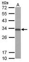 ATPase H+ Transporting V1 Subunit E1 antibody, GTX101799, GeneTex, Western Blot image 