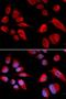 Cystathionine-Beta-Synthase antibody, LS-C331462, Lifespan Biosciences, Immunofluorescence image 