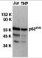 Docking protein 1 antibody, 1107, ProSci Inc, Western Blot image 