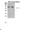TNF Receptor Superfamily Member 11a antibody, LS-C813928, Lifespan Biosciences, Western Blot image 