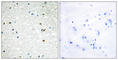 Poly(ADP-Ribose) Polymerase Family Member 3 antibody, abx014054, Abbexa, Western Blot image 
