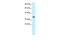 General Transcription Factor IIH Subunit 3 antibody, PA5-40374, Invitrogen Antibodies, Western Blot image 