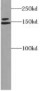 FA Complementation Group D2 antibody, FNab03006, FineTest, Western Blot image 