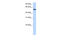 Diphthamide Biosynthesis 2 antibody, 30-786, ProSci, Western Blot image 