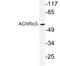 Cholinergic Receptor Nicotinic Alpha 3 Subunit antibody, LS-C177230, Lifespan Biosciences, Western Blot image 