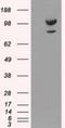 Alpha-actinin-1 antibody, NBP1-48251, Novus Biologicals, Western Blot image 
