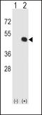 Major Histocompatibility Complex, Class I, E antibody, 63-499, ProSci, Western Blot image 