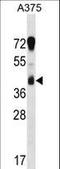 Reticulocalbin 1 antibody, LS-C162518, Lifespan Biosciences, Western Blot image 