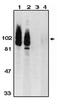 ADAM Metallopeptidase Domain 17 antibody, orb108725, Biorbyt, Western Blot image 