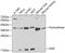 Fragile Histidine Triad Diadenosine Triphosphatase antibody, GTX54037, GeneTex, Western Blot image 