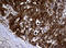 NME/NM23 Nucleoside Diphosphate Kinase 1 antibody, LS-C175610, Lifespan Biosciences, Immunohistochemistry frozen image 