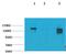 Solute Carrier Family 12 Member 4 antibody, A02864, Boster Biological Technology, Western Blot image 