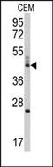 BCL2 Like 13 antibody, AP14728PU-N, Origene, Western Blot image 