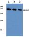 ATP Binding Cassette Subfamily A Member 8 antibody, PA5-36429, Invitrogen Antibodies, Western Blot image 