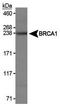 BRCA1 DNA Repair Associated antibody, NB100-598, Novus Biologicals, Western Blot image 