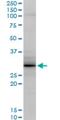 Grancalcin antibody, H00025801-M04, Novus Biologicals, Western Blot image 
