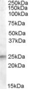 Autophagy Related 16 Like 1 antibody, 46-814, ProSci, Western Blot image 