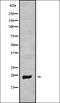 Mitochondrially Encoded NADH:Ubiquinone Oxidoreductase Core Subunit 6 antibody, orb338472, Biorbyt, Western Blot image 