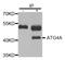 Cysteine protease ATG4A antibody, STJ22708, St John