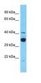 Tudor Domain Containing 12 antibody, orb327115, Biorbyt, Western Blot image 