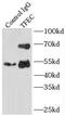 Transcription Factor EC antibody, FNab08628, FineTest, Immunoprecipitation image 