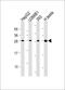 C-Type Lectin Domain Family 1 Member B antibody, M06619, Boster Biological Technology, Western Blot image 