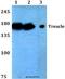 Treacle Ribosome Biogenesis Factor 1 antibody, A02653-1, Boster Biological Technology, Western Blot image 