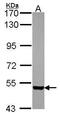 PDZ Domain Containing 1 antibody, PA5-30120, Invitrogen Antibodies, Western Blot image 