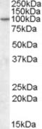 ArfGAP With GTPase Domain, Ankyrin Repeat And PH Domain 2 antibody, EB09314, Everest Biotech, Western Blot image 