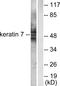 Keratin 7 antibody, LS-C118502, Lifespan Biosciences, Western Blot image 