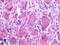 MAS Related GPR Family Member X2 antibody, LS-A6645, Lifespan Biosciences, Immunohistochemistry paraffin image 