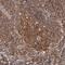 Phenylalanyl-TRNA Synthetase Subunit Alpha antibody, NBP1-88067, Novus Biologicals, Immunohistochemistry paraffin image 