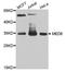 Mediator Complex Subunit 6 antibody, A8181, ABclonal Technology, Western Blot image 
