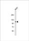 Sosondowah Ankyrin Repeat Domain Family Member D antibody, PA5-48283, Invitrogen Antibodies, Western Blot image 