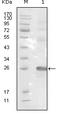 EPH Receptor B3 antibody, M04659, Boster Biological Technology, Western Blot image 