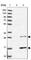 RAB, Member Of RAS Oncogene Family Like 2A antibody, HPA044007, Atlas Antibodies, Western Blot image 