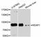 Kelch Like ECH Associated Protein 1 antibody, STJ24306, St John