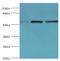 Aldehyde Dehydrogenase 1 Family Member B1 antibody, LS-B15230, Lifespan Biosciences, Western Blot image 