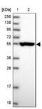 Cartilage Associated Protein antibody, PA5-60431, Invitrogen Antibodies, Western Blot image 