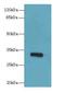 Protein Phosphatase 1 Regulatory Subunit 3B antibody, LS-B15189, Lifespan Biosciences, Western Blot image 