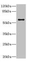 Cytochrome P450 Family 4 Subfamily V Member 2 antibody, LS-C675616, Lifespan Biosciences, Western Blot image 