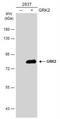 G Protein-Coupled Receptor Kinase 2 antibody, NBP2-16747, Novus Biologicals, Western Blot image 