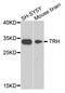 Thyrotropin Releasing Hormone antibody, STJ110620, St John