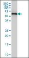 Phenylalanyl-TRNA Synthetase Subunit Beta antibody, orb89752, Biorbyt, Western Blot image 