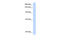 Minichromosome Maintenance 8 Homologous Recombination Repair Factor antibody, 28-545, ProSci, Western Blot image 